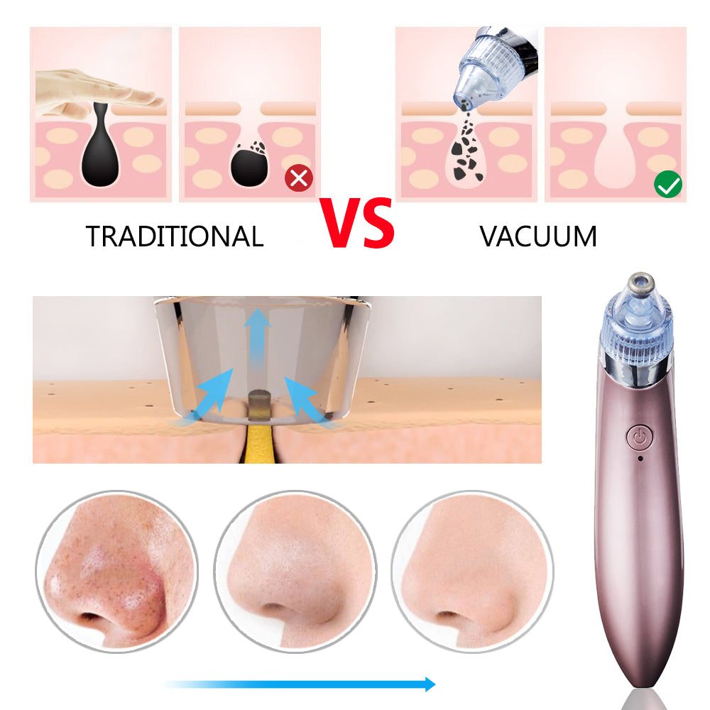 Aspirator Vacuum Facial pentru Curatarea Tenului si a Punctelor Negre Deep Cleaner Pro